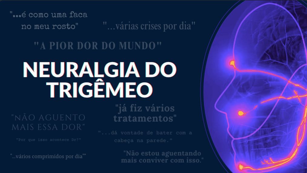 Cirurgia para Tratamento de Neuralgia do Trigêmeo Dr Irlon